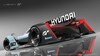 Hyundai N
