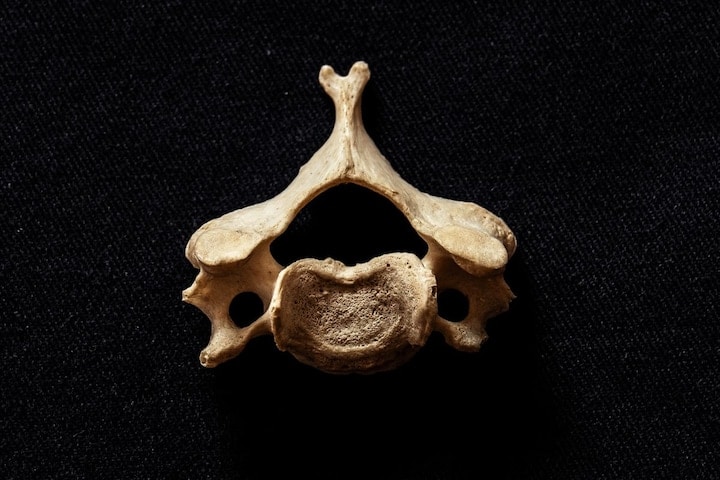 Ruggengraat -vertebra - wervel