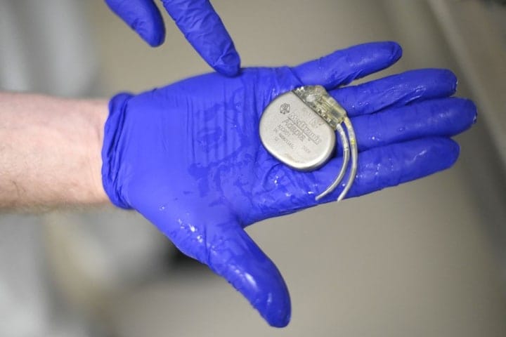 Pacemaker (ANP)