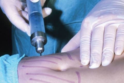 Lipodiesel gaat het worden in 2009