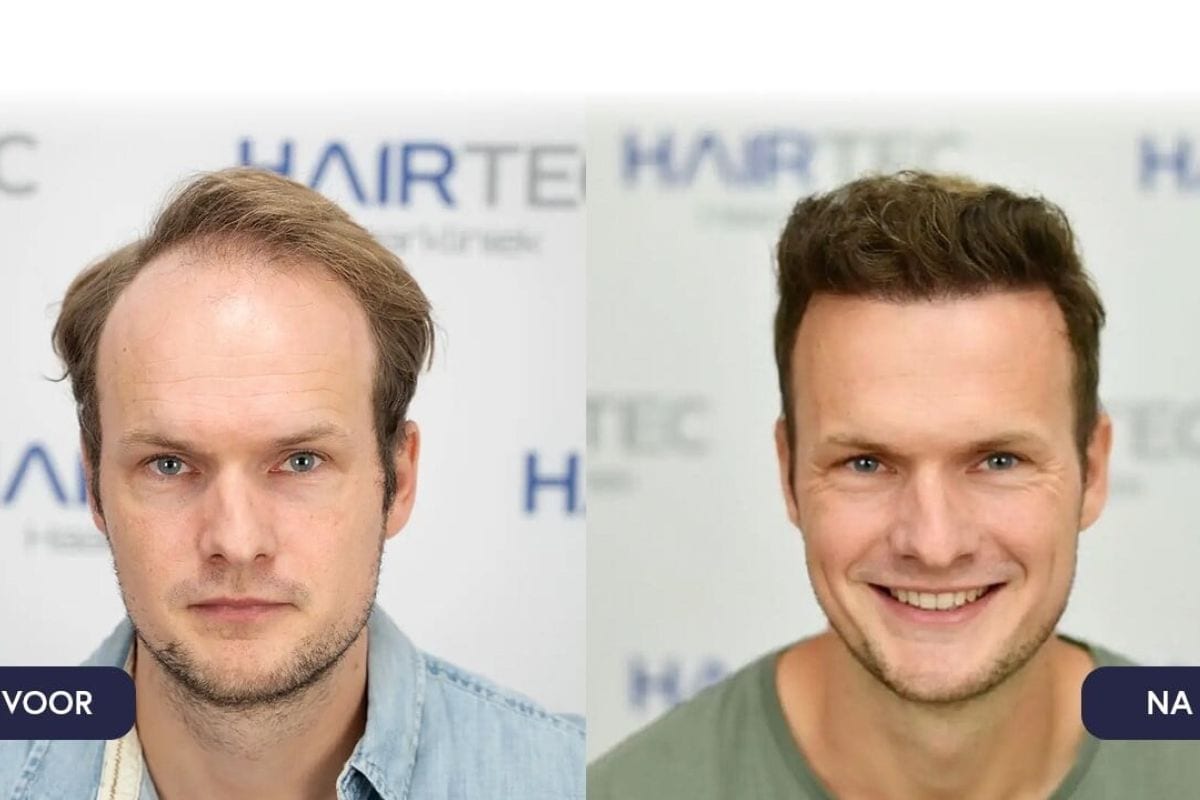 Hairtec advertroial (ON-112419)